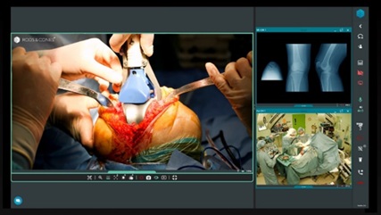 Lo que ve el cirujano, vista panorámica,  video del monitor son algunas de las imágenes que se transmiten en tiempo real a computadoras o dispositivos móviles